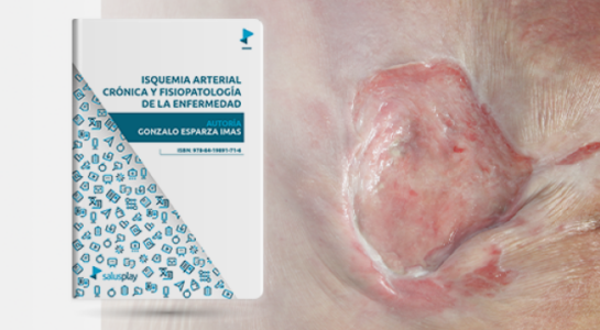 v-isquemia-arterial-cronica-y-fisiopatologia-de-la-enfermeda-1727342855