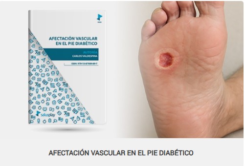 Afectacion Vascular Pie Diabetico